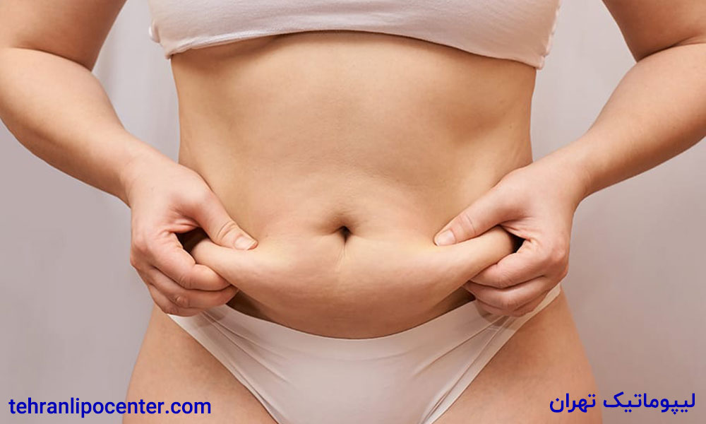 لیپوماتیک و پیکرتراشی ۳۶۰ درجه در ونک