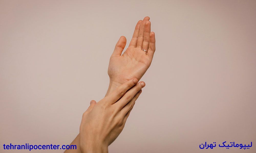 تزریق چربی به دست در ونک