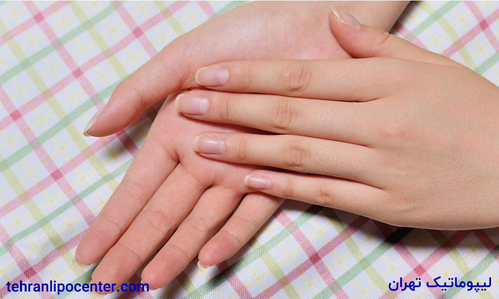 تزریق چربی به دست در ونک