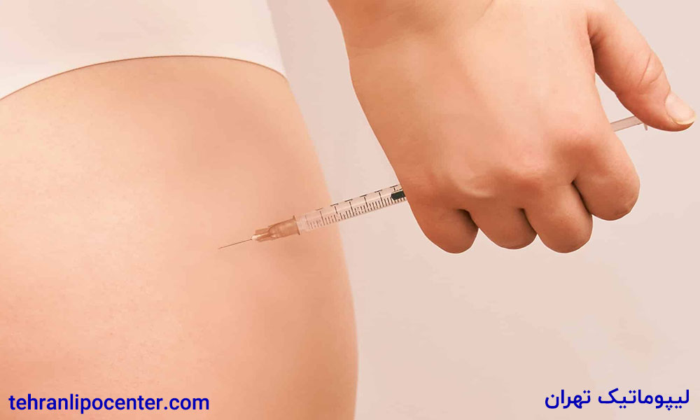 تزریق چربی به باسن در ونک