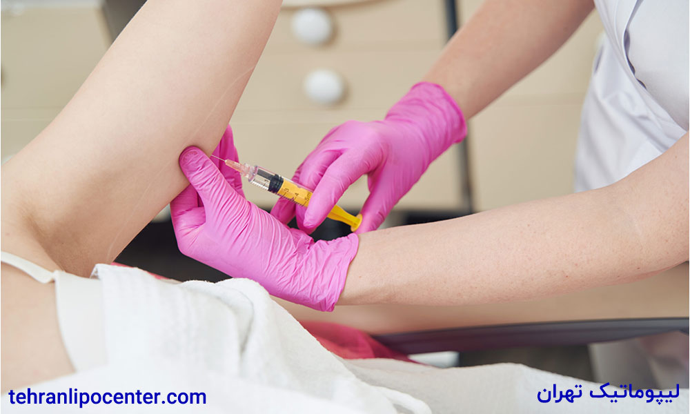 تزریق چربی به ران در ونک