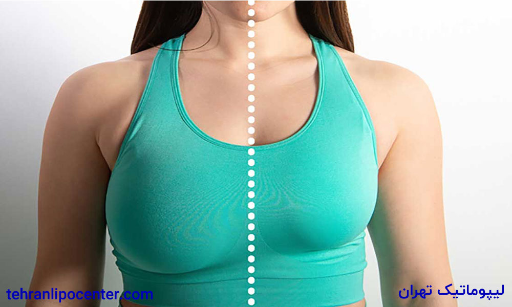 بهترین دکتر جراح ماموپلاستی در ونک