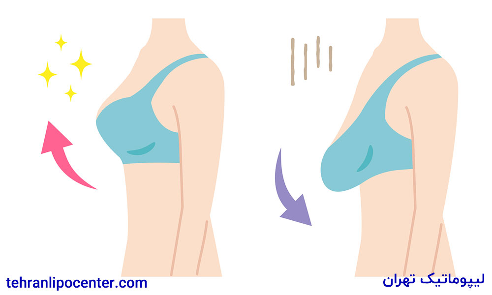 بهترین دکتر جراح ماموپلاستی در ونک